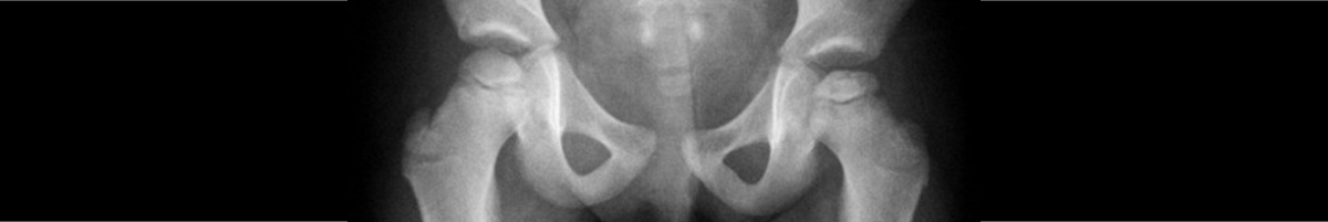 healthkey_content_kinderorthopaedie_spotlight.png